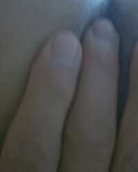 photo-thumb