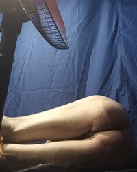 photo-thumb