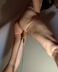 photo-thumb