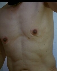 photo-thumb