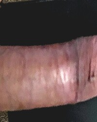 photo-thumb